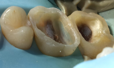 Steep angle photo before restoration showing cracks and decay